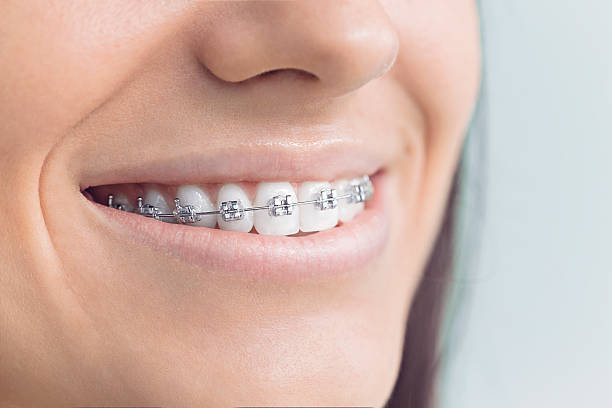 Best Teeth Whitening  in Frankston, TX